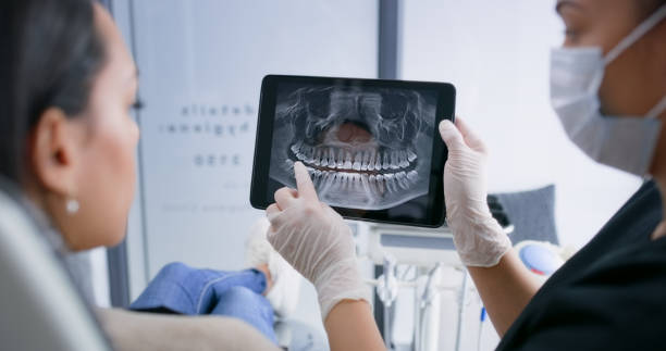 Licensed Teeth Whitening service in Lely Resort, FL - Smile Center Dentistry